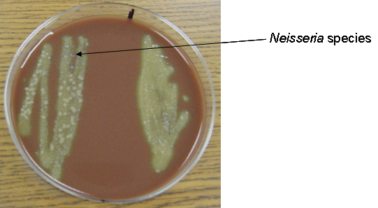 Normal Flora Of The Nasopharynx